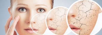 Сухая кожа. Правила профессионального ухода